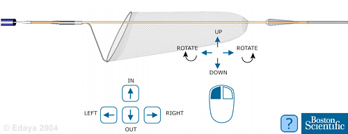 Embolic filter interactive model